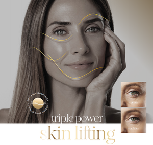 Microneedling - Monteil - Goldfadenlifting