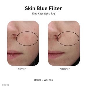 Advanced Nutrition Programme - Skin Blue Filter - Belrue