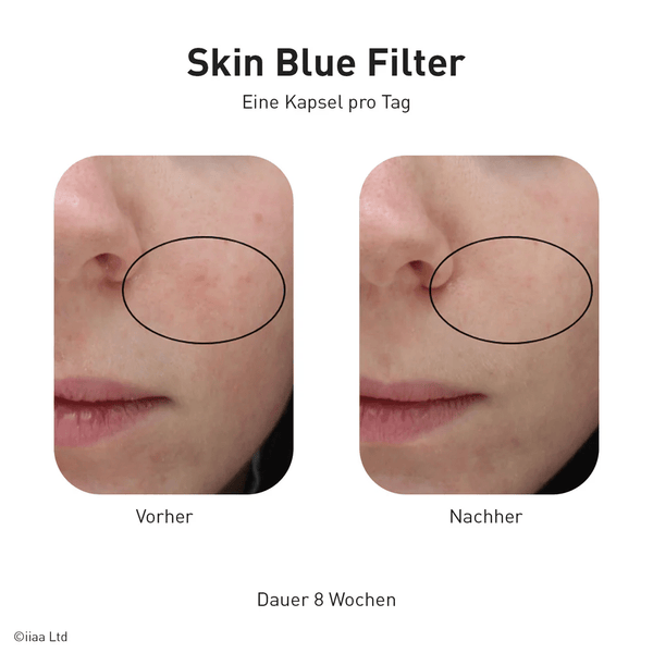 Advanced Nutrition Programme - Skin Blue Filter - Belrue
