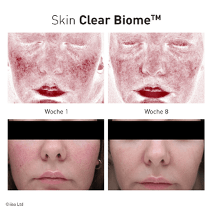 Advanced Nutrition Programme Skin Clear Biome - Belrue