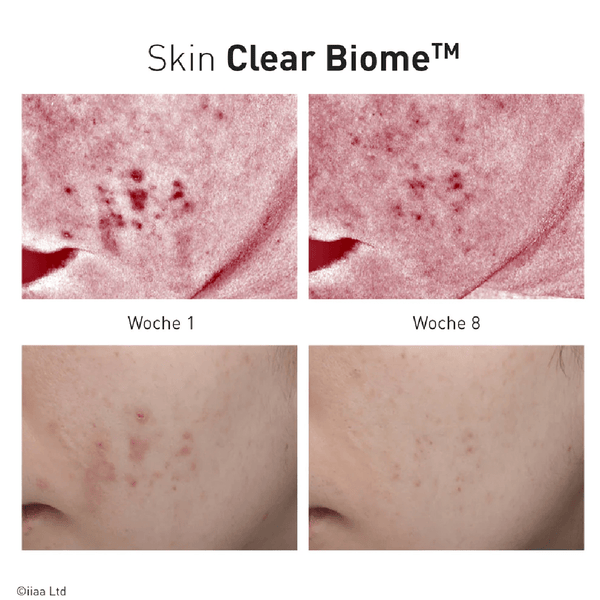 Advanced Nutrition Programme Skin Clear Biome - Belrue
