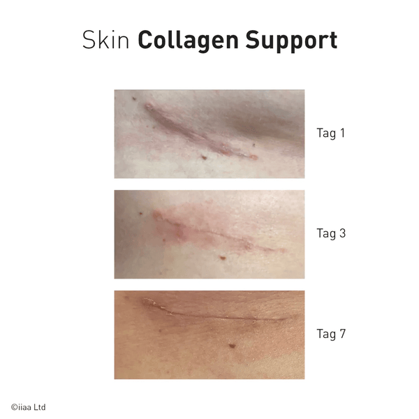 Advanced Nutrition Programme - Skin Collagen Support - Belrue