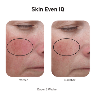 Advanced Nutrition Programme Skin Even IQ - Belrue