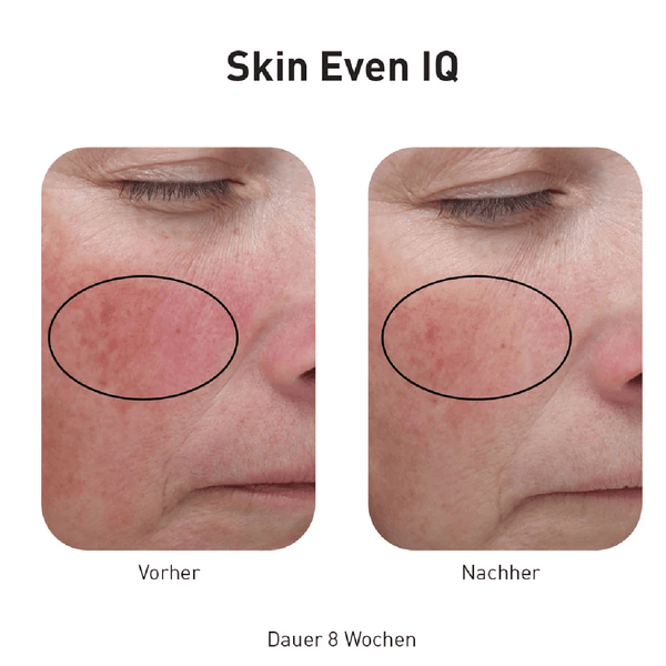 Advanced Nutrition Programme Skin Even IQ - Belrue