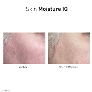Advanced Nutrition Programme Skin Moisture IQ - Belrue