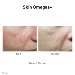 Advanced Nutrition Programme - Skin Omegas+ - Belrue
