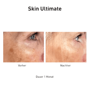 Advanced Nutrition Programme Skin Ultimate - Belrue