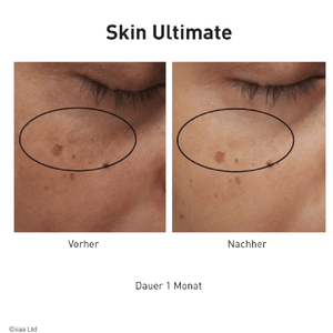 Advanced Nutrition Programme Skin Ultimate - Belrue