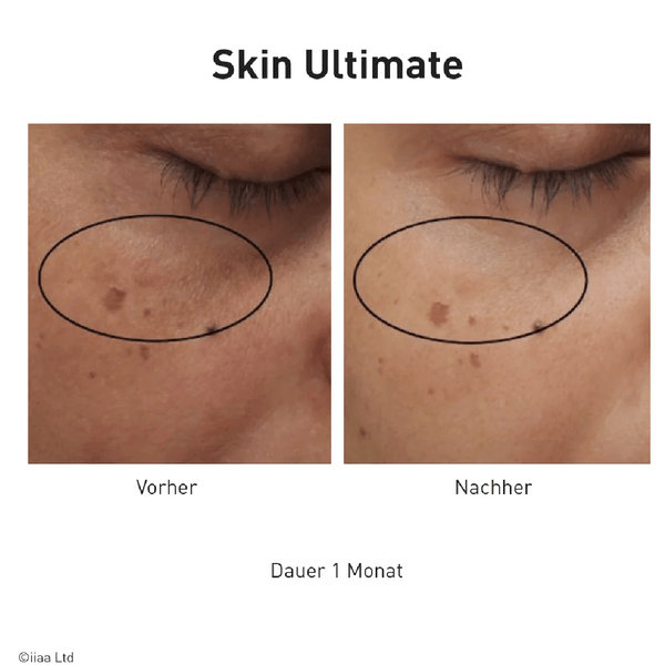 Advanced Nutrition Programme Skin Ultimate - Belrue