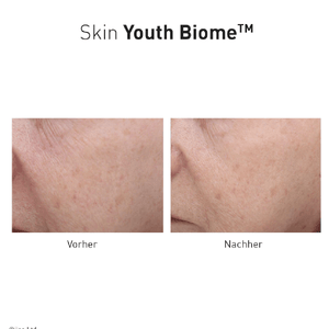 Advanced Nutrition Programme Skin Youth Biome - Belrue