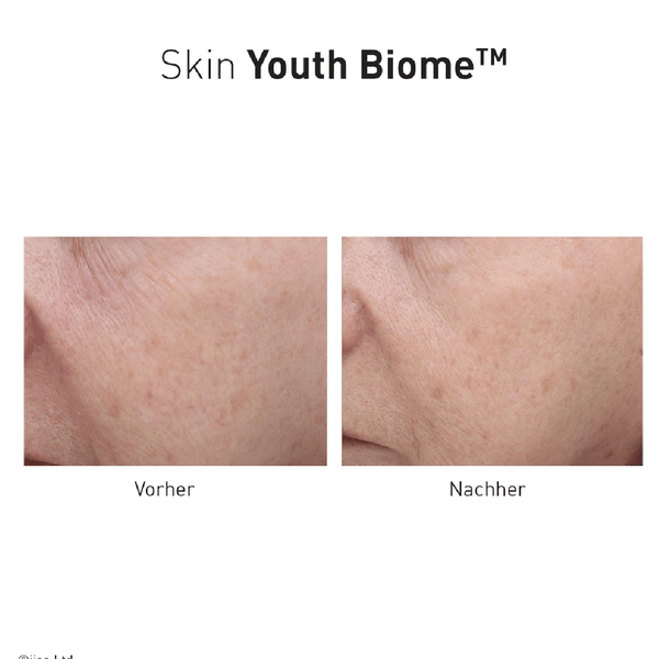Advanced Nutrition Programme Skin Youth Biome - Belrue
