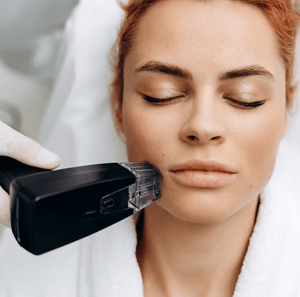 Diodenlaser - Gesicht komplett - Belrue