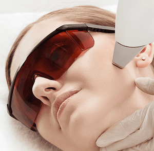 Diodenlaser - Gesichts komplett + Hals - Belrue