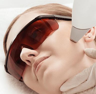 Diodenlaser - Gesichts komplett + Hals - Belrue