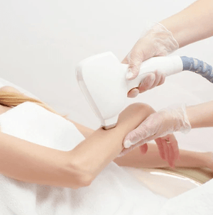 Diodenlaser - Oberarme - Belrue