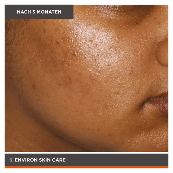 Environ Focus Care Clarity+ Botanical Infused Sebu - Spot Blemish Gel 10ml - Belrue