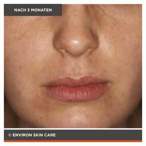 Environ Focus Care Clarity+ Botanical Infused Sebu - Tone Clarifier 100ml - Belrue