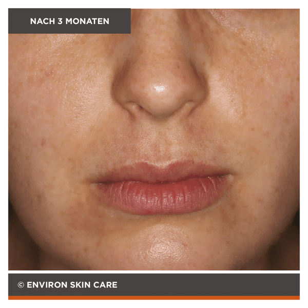 Environ Focus Care Clarity+ Botanical Infused Sebu - Tone Clarifier 100ml - Belrue