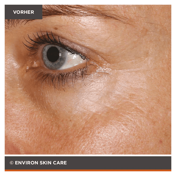 Environ Focus Care Youth+ Tri - Peptide Complex+ Avance Elixir 30ml - Belrue